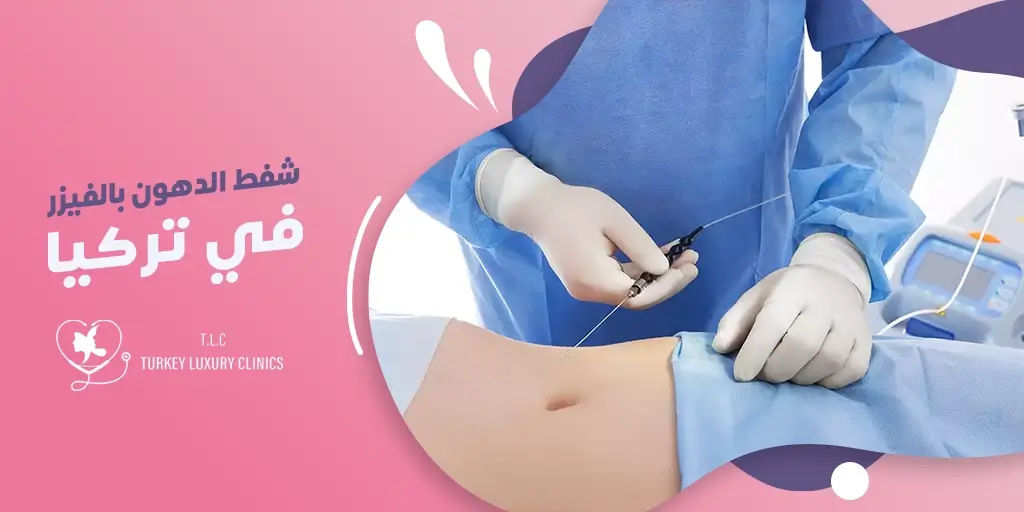 شفط الدهون بالفيزر في تركيا: دليلك الشامل