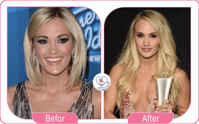 Carrie Underwood Then vs Now