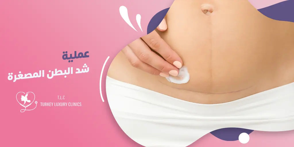 عملية شد البطن المصغرة