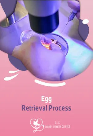 Egg Retrieval Process: Step-by-Step, Before, During, and After IVF