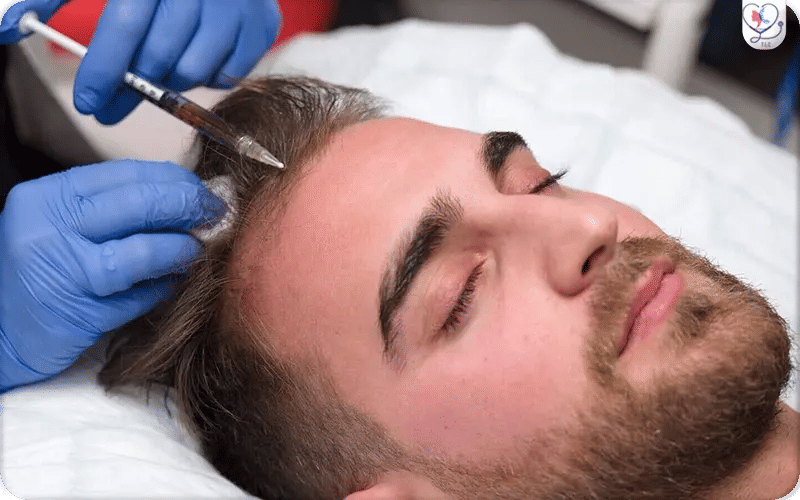 لماذا تختار Turkey Luxury Clinics لزراعة الشعر؟