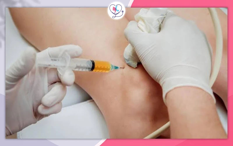 Exosome Injections for Arthritis