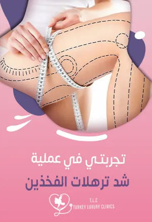 تجربتي في عملية شد ترهلات الفخذين