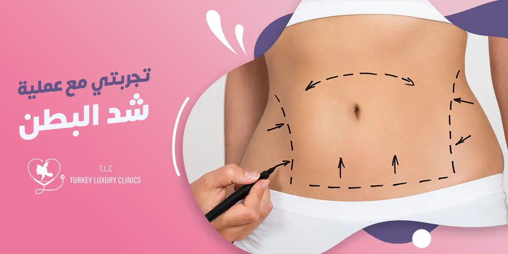 تجربتي مع عملية شد البطن