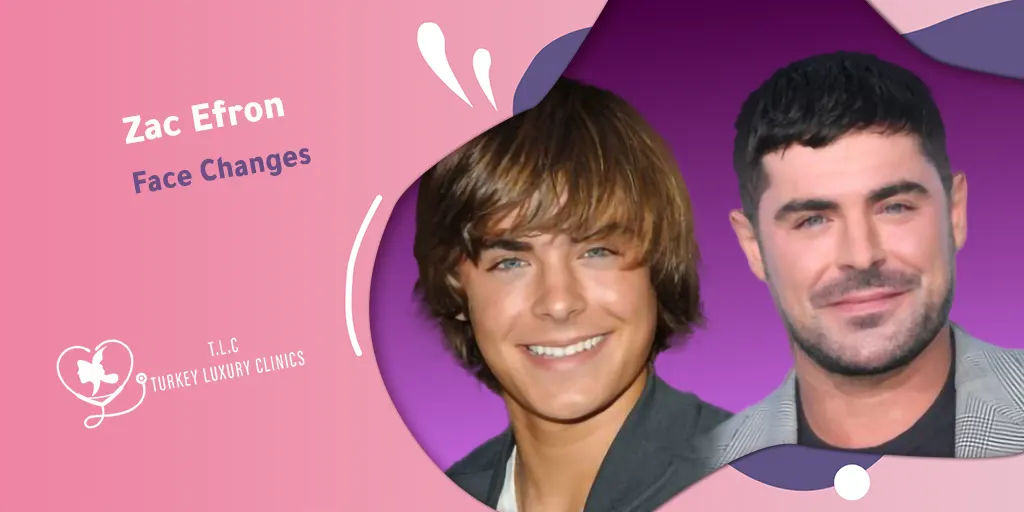 Zac Efron Face Changes: From Injury to Remarkable New Look