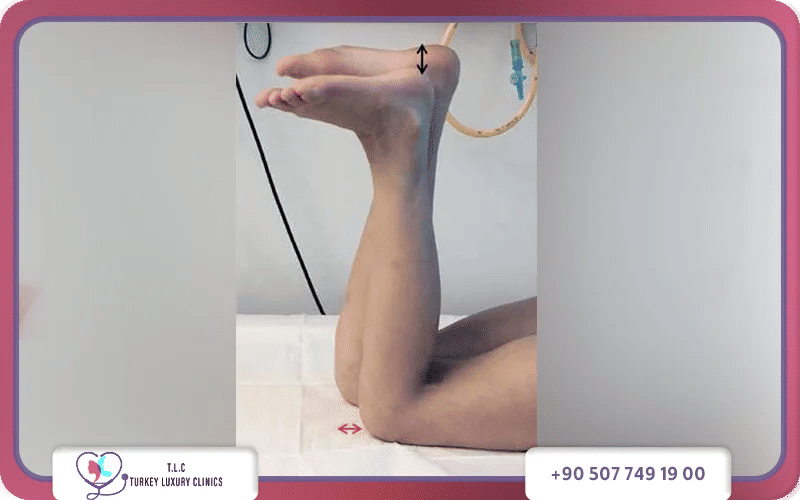 الأسباب المكتسبة