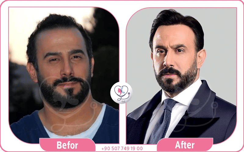 هل قصي خولي زرع شعر؟