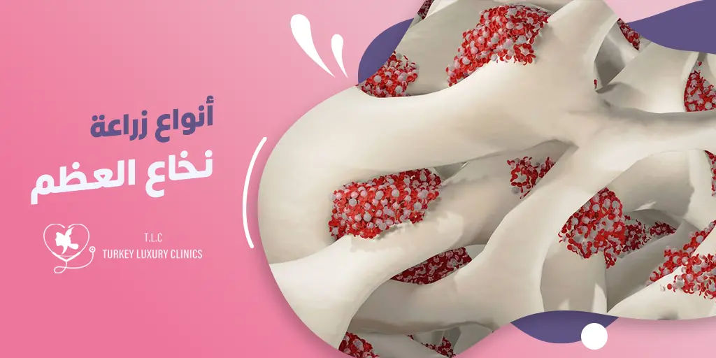 ماهي أنواع النخاع العظمي؟