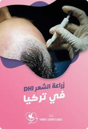 ماهي زراعة الشعر DHI في تركيا؟featured image