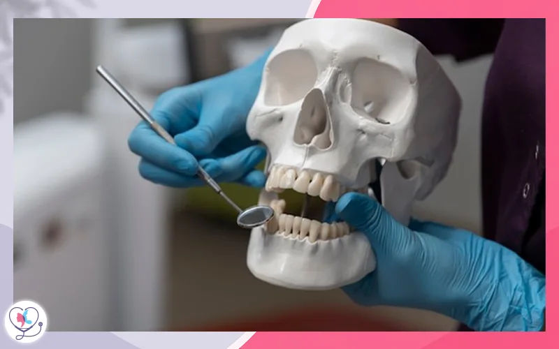 Zygomatic Implants for Severe Bone Loss