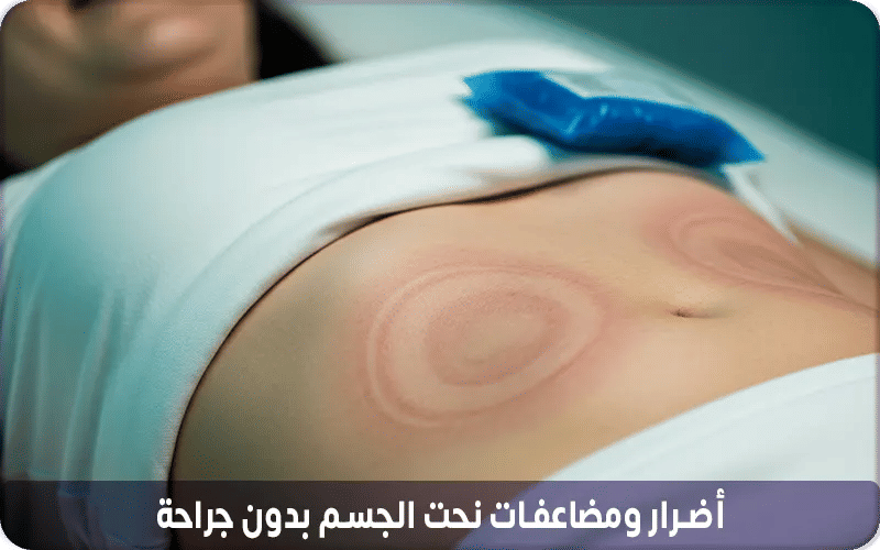 أضرار ومضاعفات نحت الجسم بدون جراحة