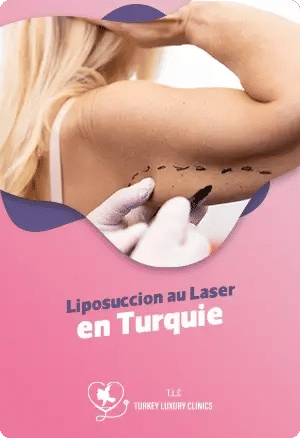 Liposuccion Laser en Turquiefeatured image