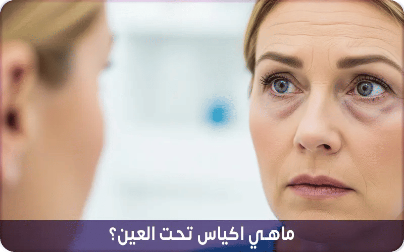 ما هي أكياس تحت العين؟
