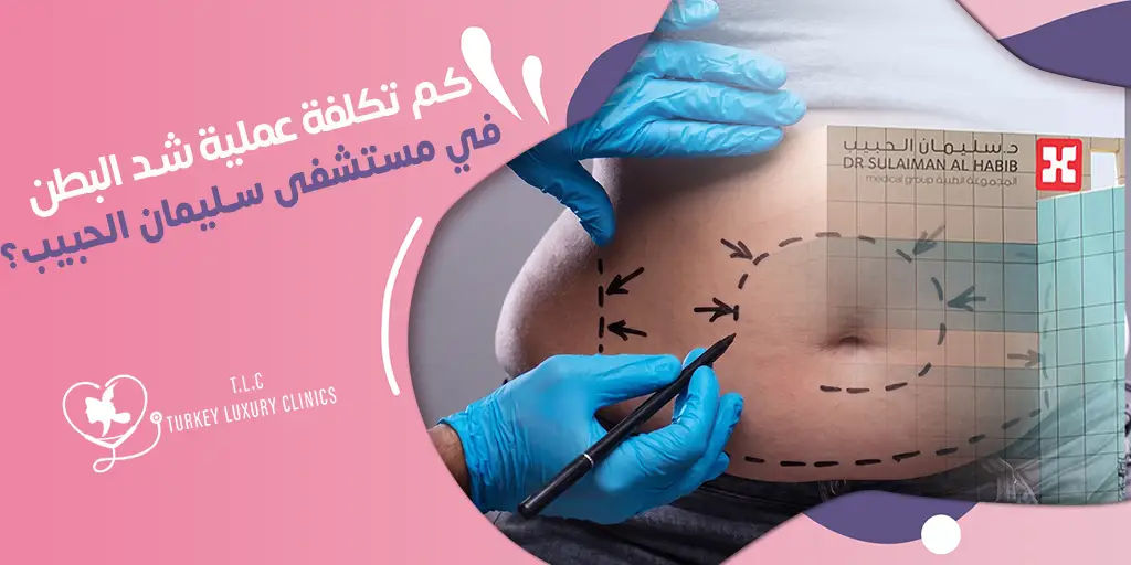 كم تكلفة عملية شد البطن في مستشفى سليمان الحبيب؟ 