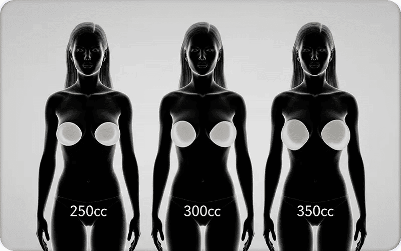 Les Tailles les plus demandées en augmentation mammaire