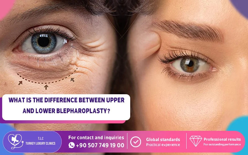 What Is the Difference Between Upper and Lower Blepharoplasty?