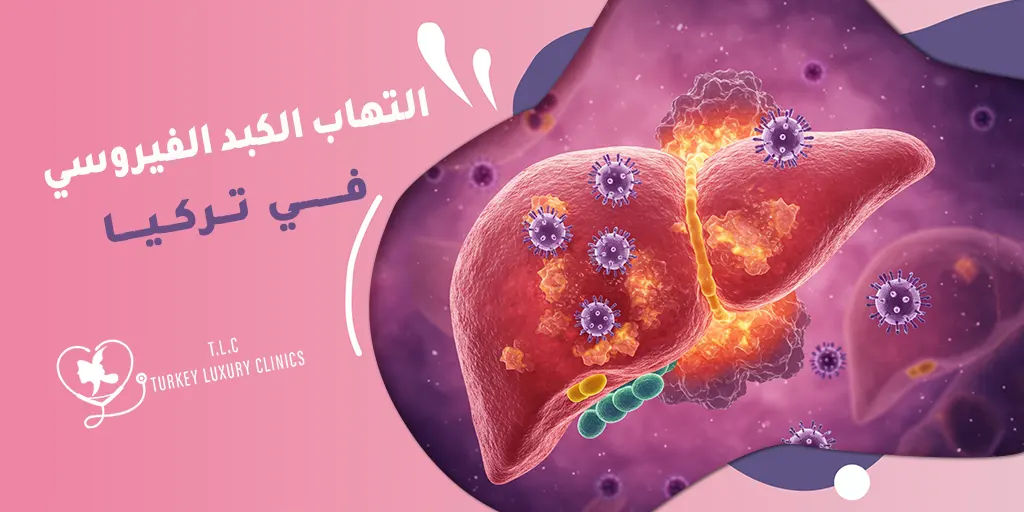 علاج التهاب الكبد الفيروسي في تركيا: كيف تختار أفضل مركز علاجي؟