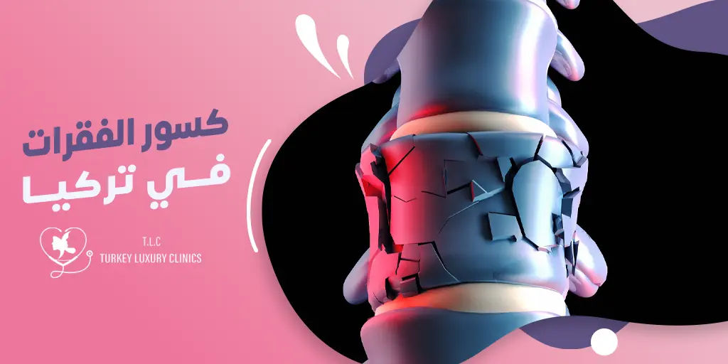 كسور الفقرات في تركيا