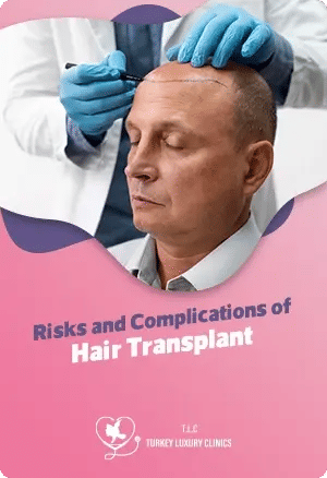 Risks and Complications of Hair Transplantfeatured image