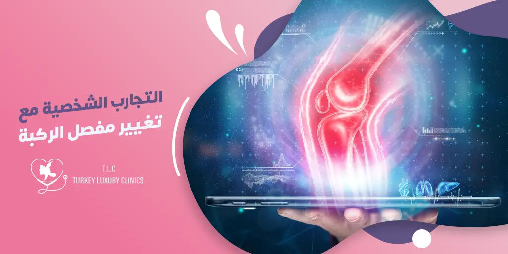 تجربتي مع عملية تغيير مفصل الركبة