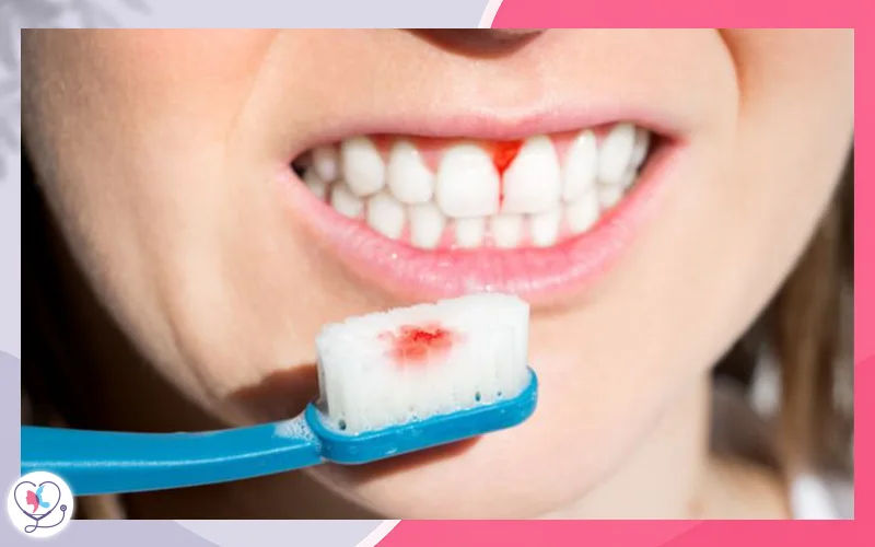 أعراض التهاب دواعم السن