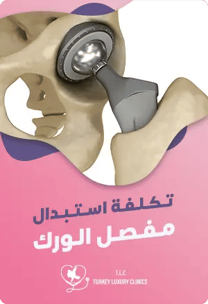 تكلفة استبدال مفصل الورك في تركيا: كل ما يهمكfeatured image