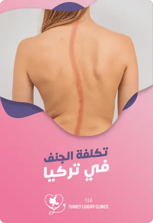 تكلفة جراحة الجنف في تركيا - الأسعار والتفاصيلfeatured image