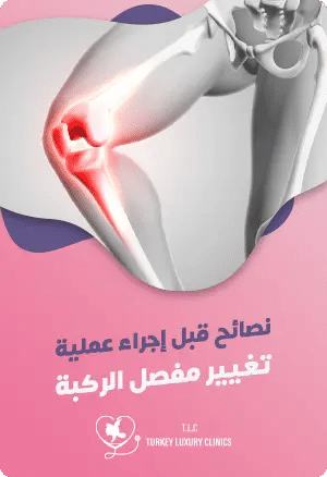 نصائح قبل إجراء عملية تغيير مفصل الركبة featured image
