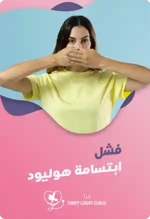 فشل ابتسامة هوليودfeatured image