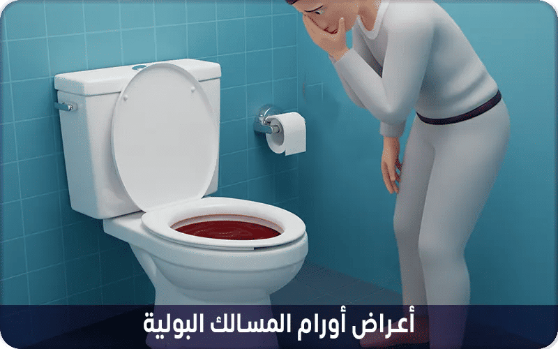 أعراض أورام المسالك البولية