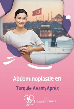 Abdominoplastie en Turquie Avant/Après : photos des résultats