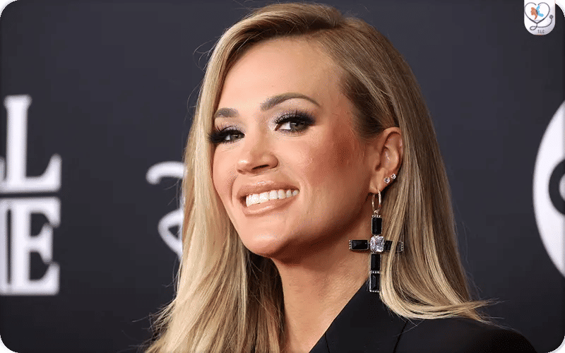 Carrie Underwood Plastic Surgery