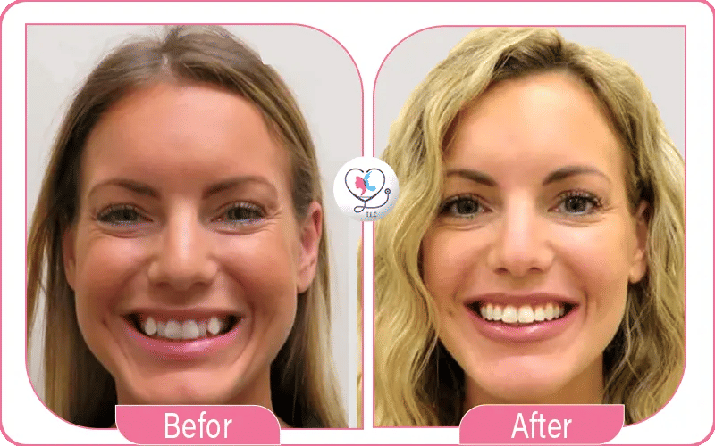 ما هو التقويم المعدني؟