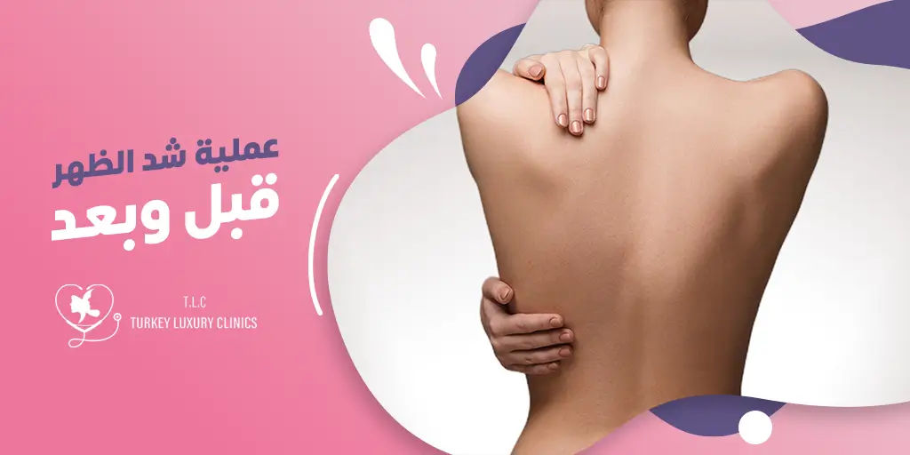 عملية شد الظهر قبل وبعد