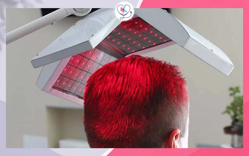 العلاج بالبلازما الغنية بالصفائح (PRP) والليزر منخفض الطاقة (LLLT)