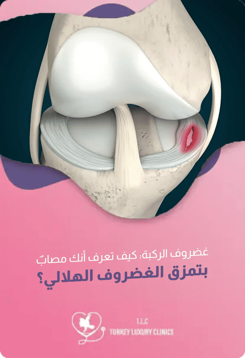 غضروف الركبة: الإصابات والأعراض والعلاج في تركيا