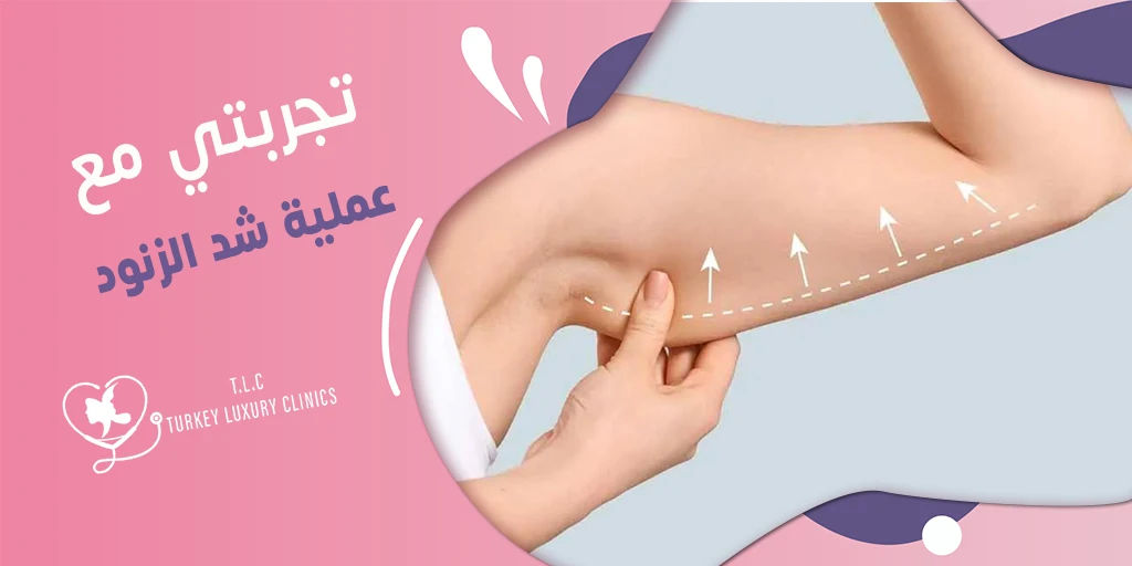 الزنود قبل وبعد: صور حقيقة من تجربتي مع عملية شد الزنود