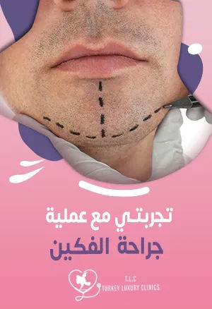 تجربتي مع عملية جراحة الفكين: النتائج بالصور قبل وبعد
