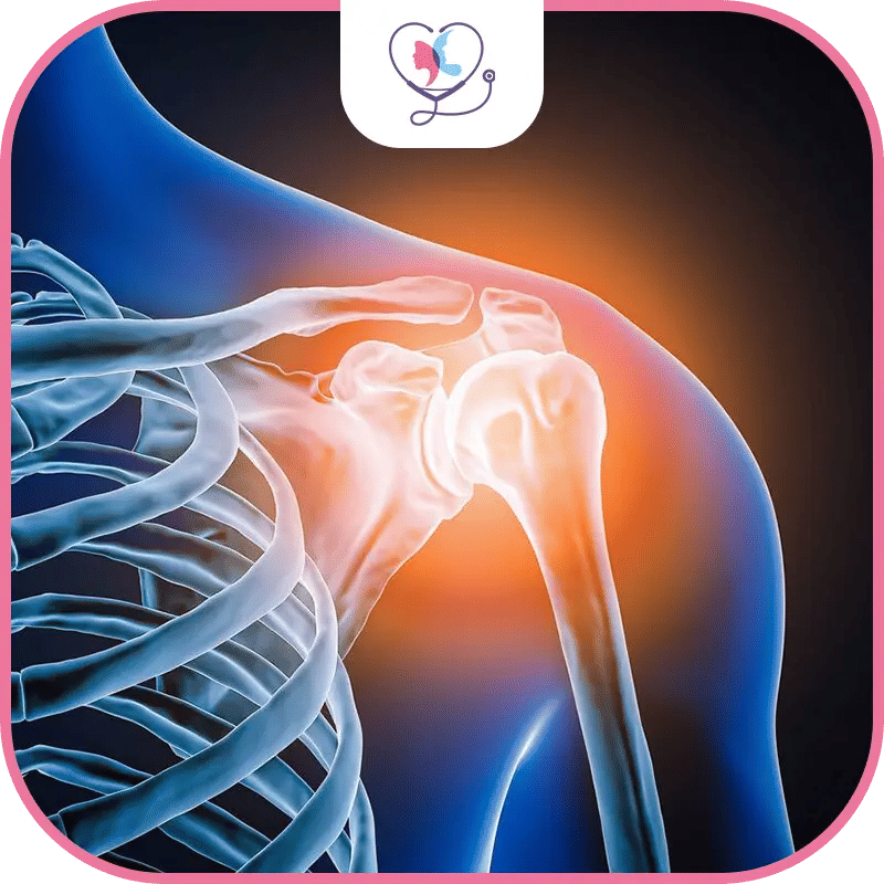 تكلفة عملية استبدال مفصل الكتف في تركيا