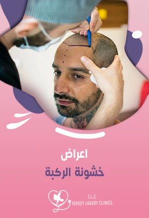 Best Hair Transplant Surgeon in Turkey: Leading Expert in DHI, FUE & Stem Cell Therapyfeatured image