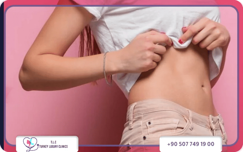 عملية تجميل السرة في تركيا لاكشري كلينك عملية تجميل السرة في تركيا لاكشري كلينك