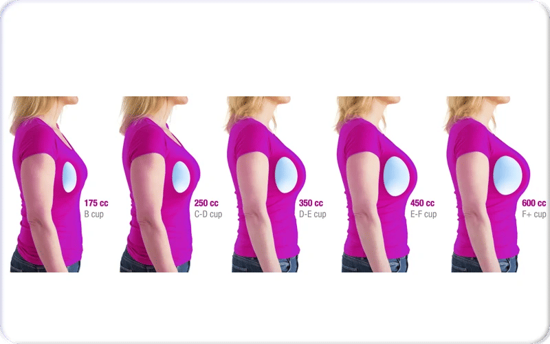 Que représente un implant mammaire de 450cc ?