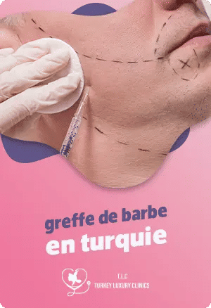 La greffe de barbe en Turquie