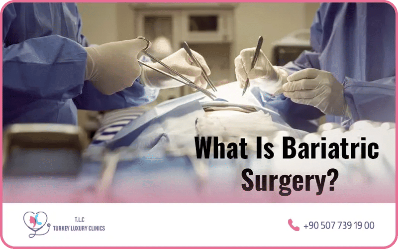 La chirurgie bariatrique 