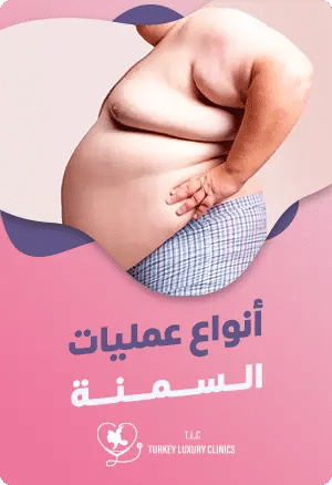 أنواع عمليات السمنة featured image