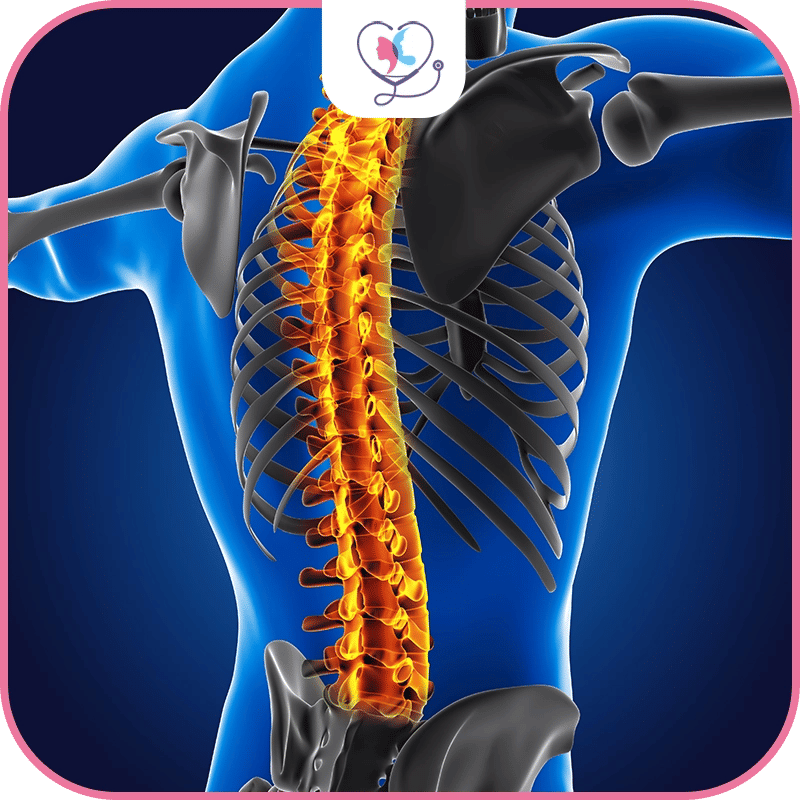 الجنف Scoliosis