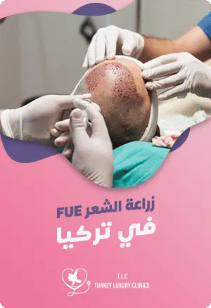 ماهي زراعة الشعر بالاقتطاف FUE في تركيا؟featured image