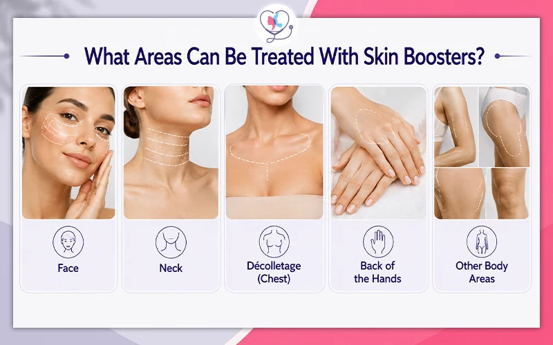 What Areas Can Be Treated With Skin Boosters?