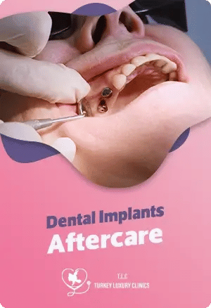 Dental Implant Aftercare: Your Guide to a Speedy Recoveryfeatured image