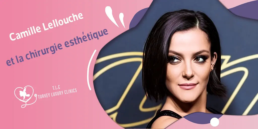 Camille Lellouche et la chirurgie esthétique : vérité, rumeurs et avant/après